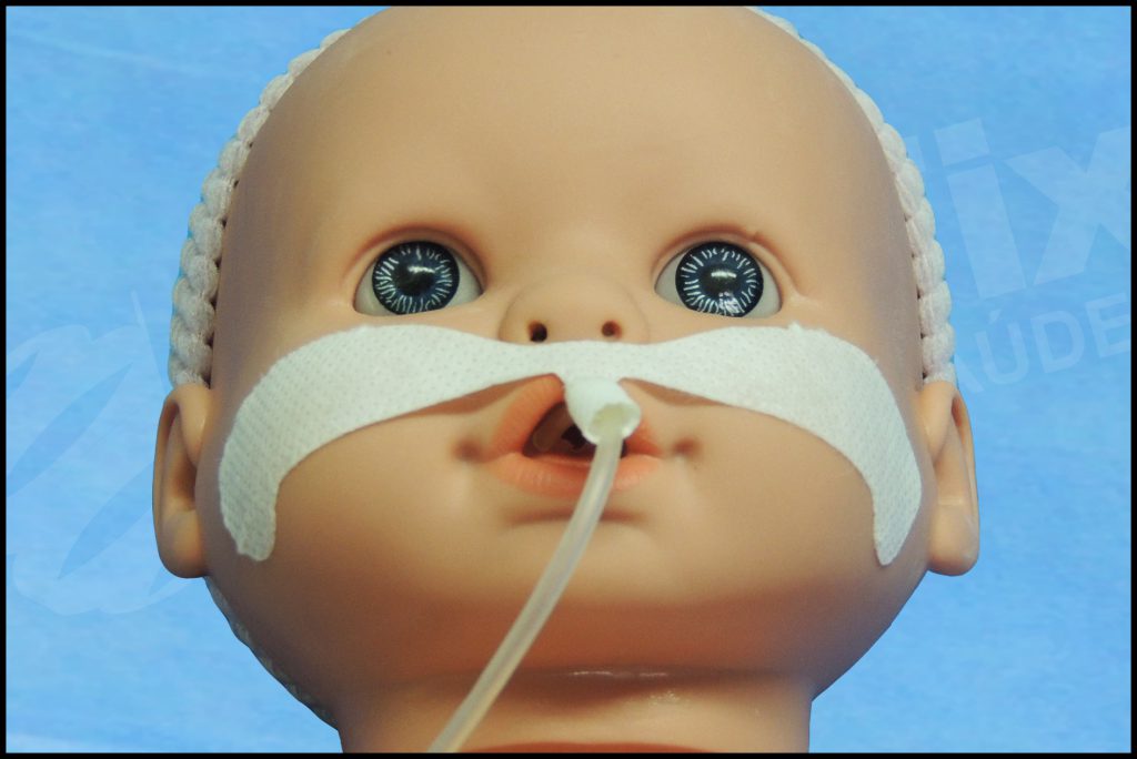 Fixador De Tubos Sondas E Cateteres Endotraqueal Neonatal Pp F